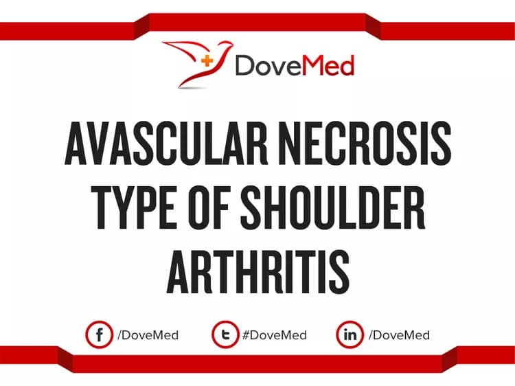 Avascular Necrosis type of Shoulder Arthritis