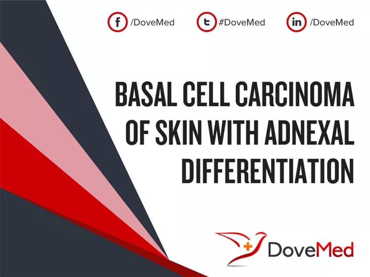 Basal Cell Carcinoma of Skin with Adnexal Differentiation