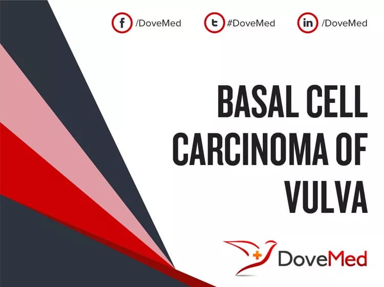 Basal Cell Carcinoma of Vulva