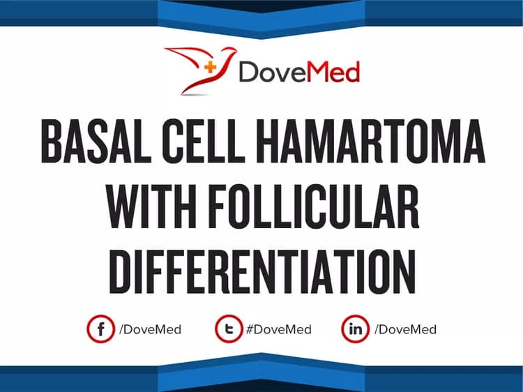 Basal Cell Hamartoma with Follicular Differentiation