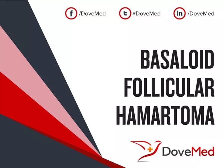 Basaloid Follicular Hamartoma