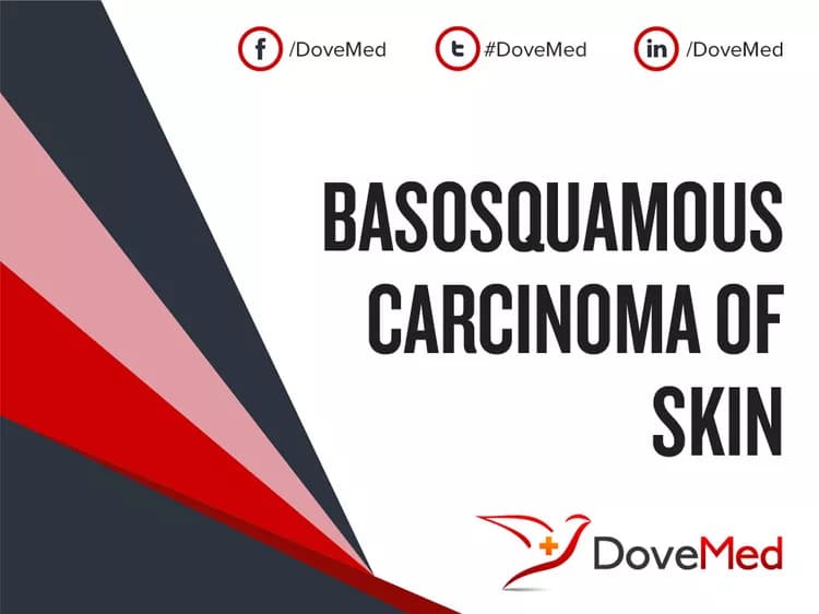 Basosquamous Carcinoma of Skin