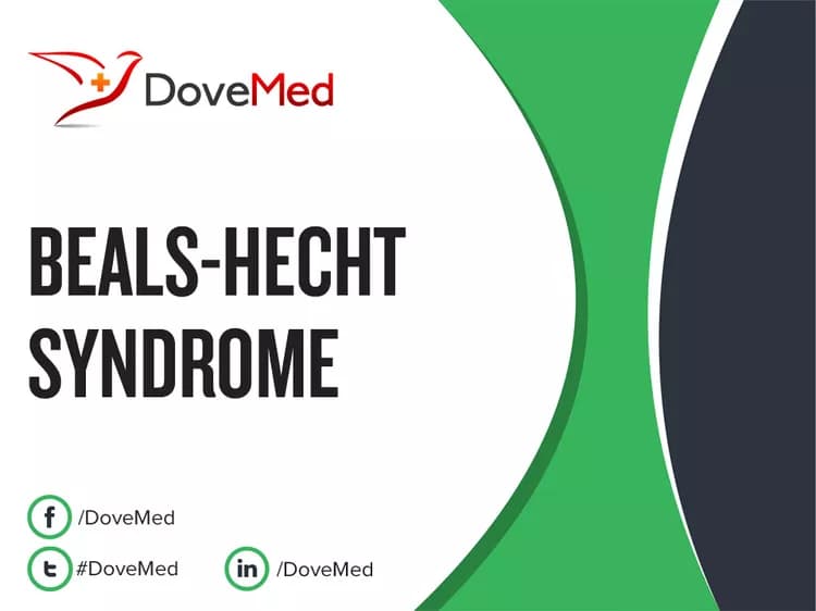Beals-Hecht Syndrome