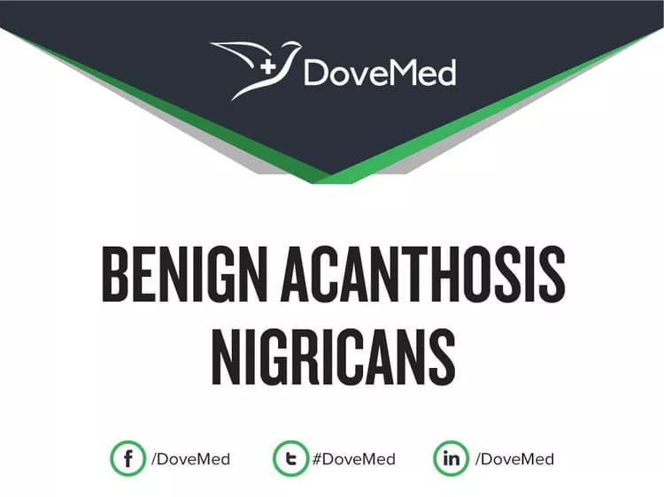 Benign Acanthosis Nigricans