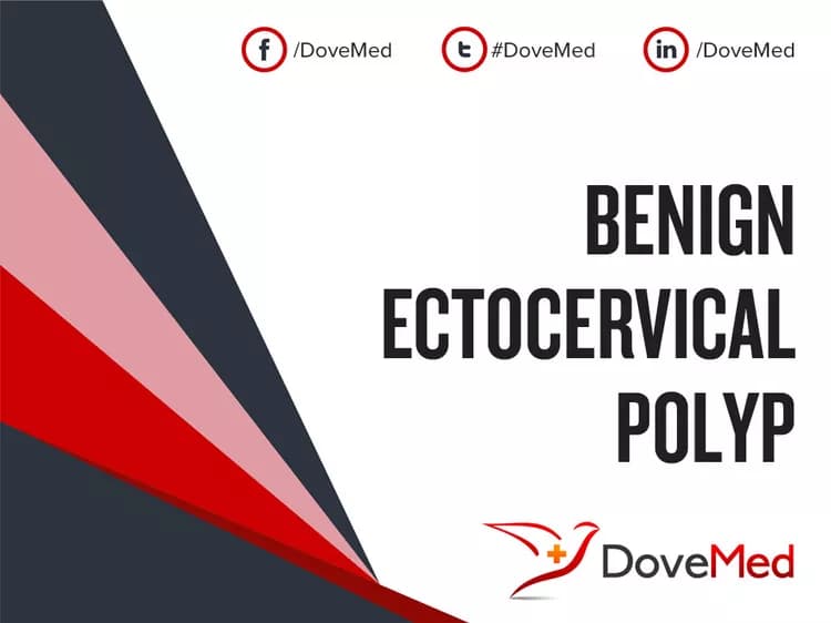 Benign Ectocervical Polyp