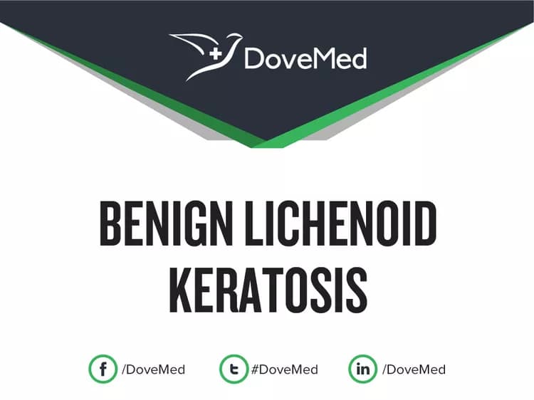 Benign Lichenoid Keratosis