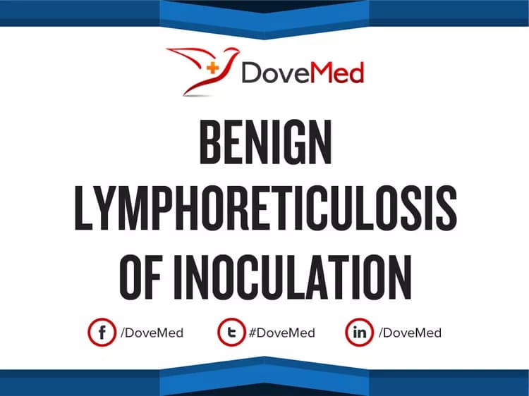 Benign Lymphoreticulosis of Inoculation