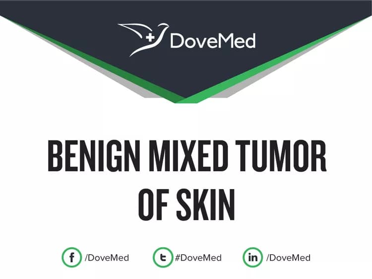 Benign Mixed Tumor of Skin