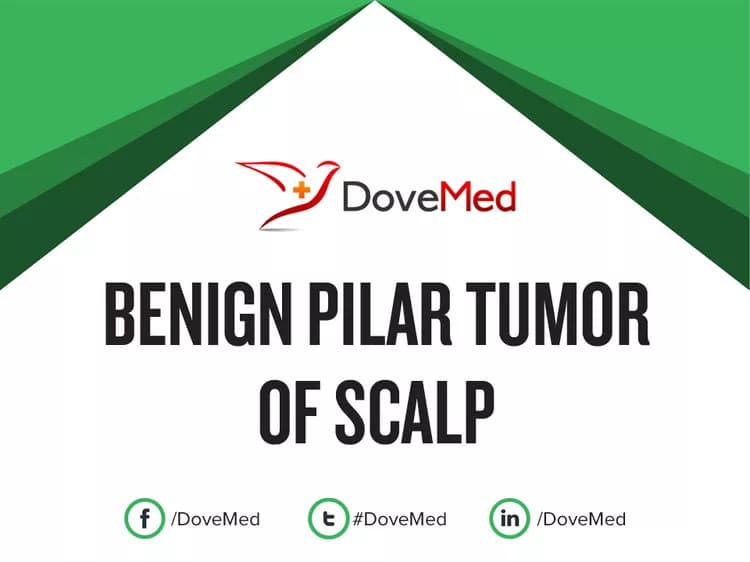 Benign Pilar Tumor of Scalp