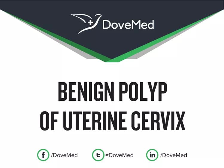 Benign Polyp of Uterine Cervix