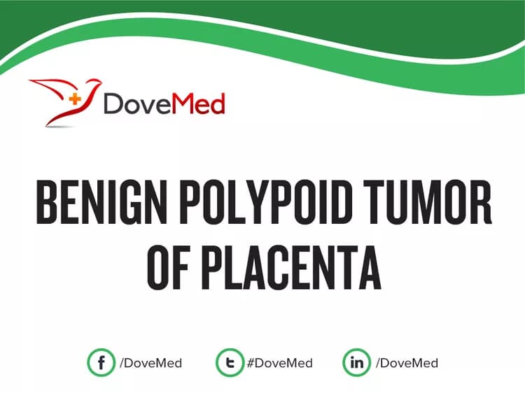 Benign Polypoid Tumor of Placenta