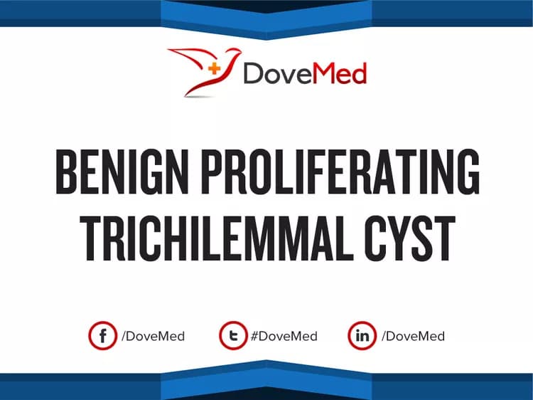 Benign Proliferating Trichilemmal Cyst