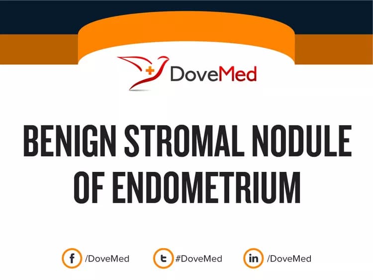 Benign Stromal Nodule of Endometrium