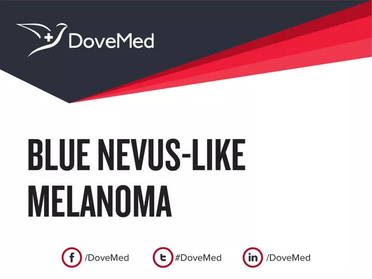 Blue Nevus-like Melanoma