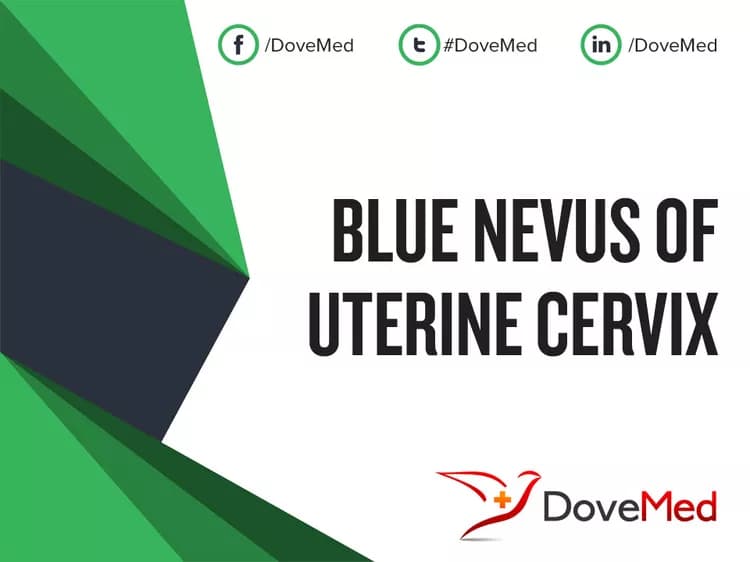 Blue Nevus of Uterine Cervix