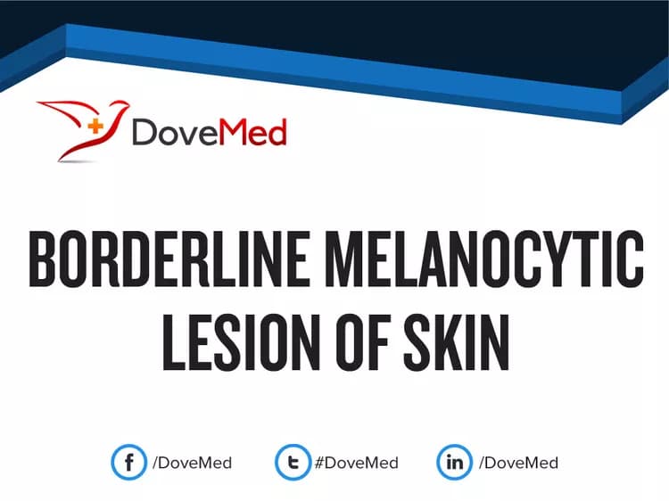Borderline Melanocytic Lesion of Skin