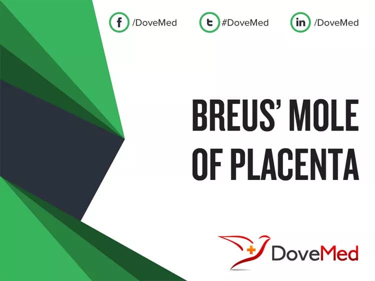 Breus’ Mole of Placenta