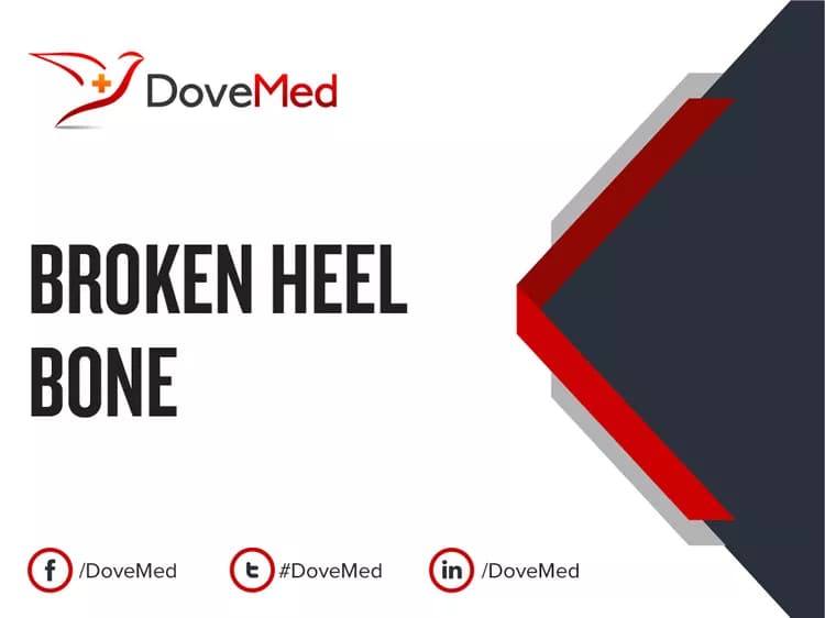 Broken Heel Bone
