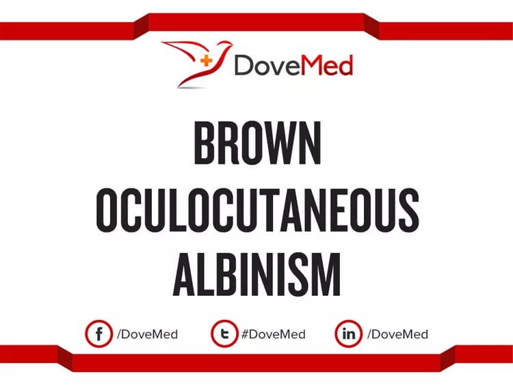 Brown Oculocutaneous Albinism