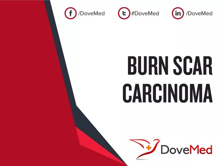 Burn Scar Carcinoma