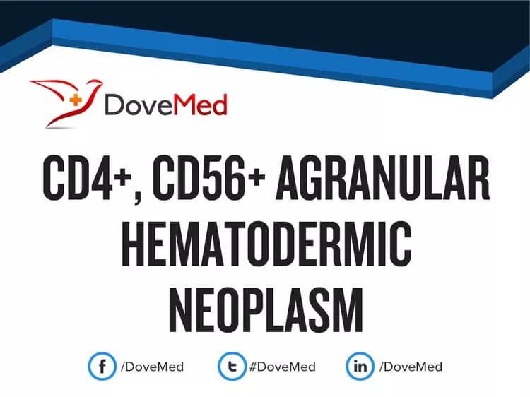 CD4+, CD56+ Agranular Hematodermic Neoplasm
