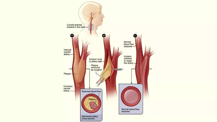 National Heart Lung and Blood Insitute (NIH)