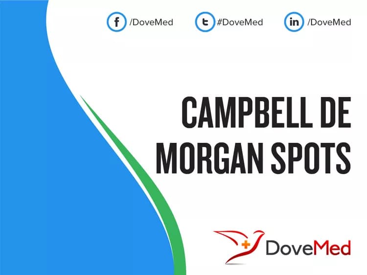 Campbell De Morgan spots