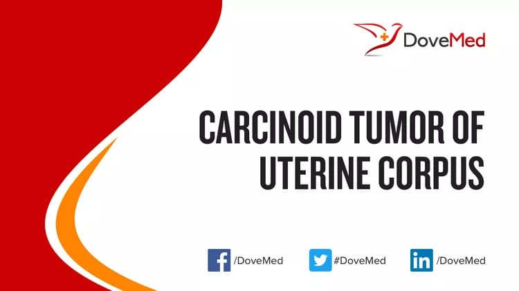 Carcinoid Tumor of Uterine Corpus