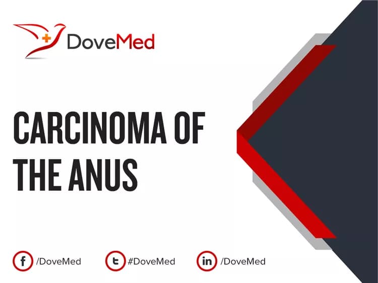 Carcinoma of the Anus