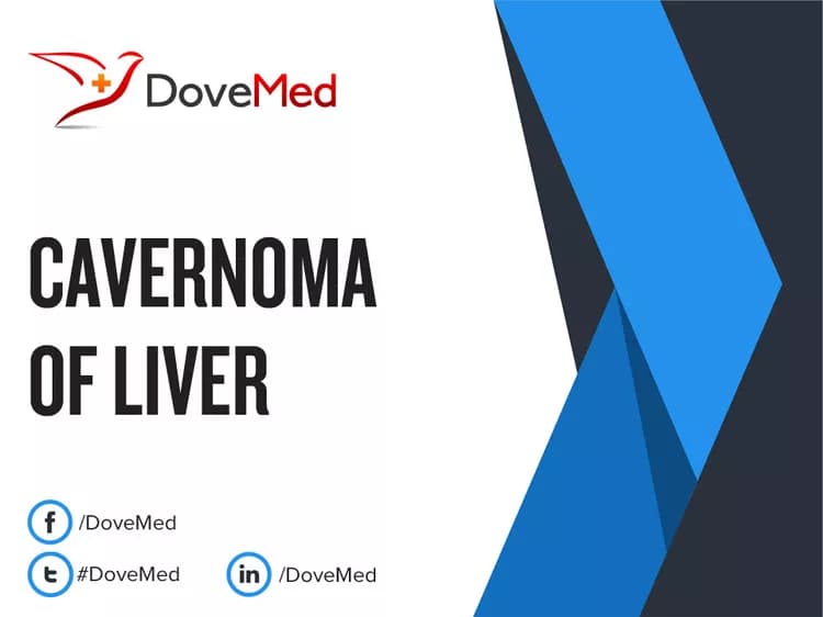 Cavernoma of Liver