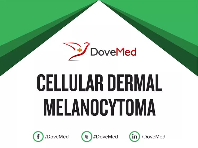 Cellular Dermal Melanocytoma