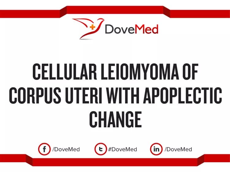 Cellular Leiomyoma of Corpus Uteri with Apoplectic Change