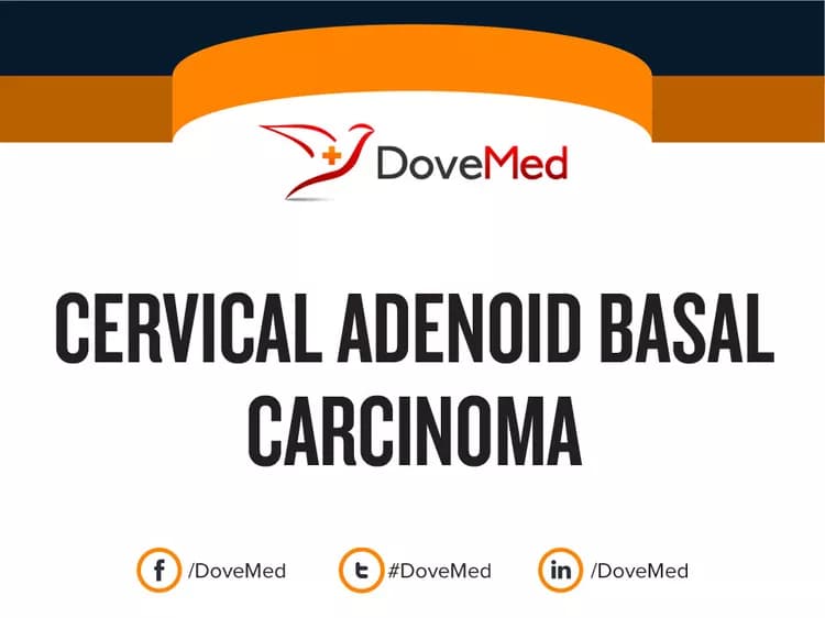 Cervical Adenoid Basal Carcinoma