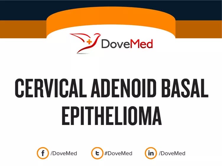 Cervical Adenoid Basal Epithelioma