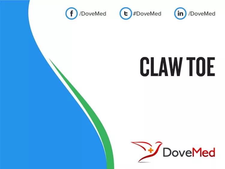 Claw Toe