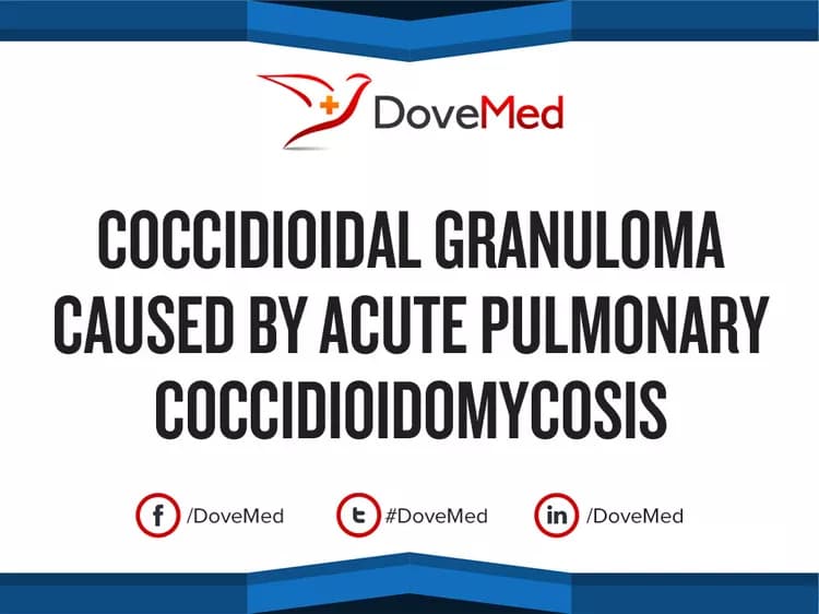 Coccidioidal Granuloma caused by Acute Pulmonary Coccidioidomycosis