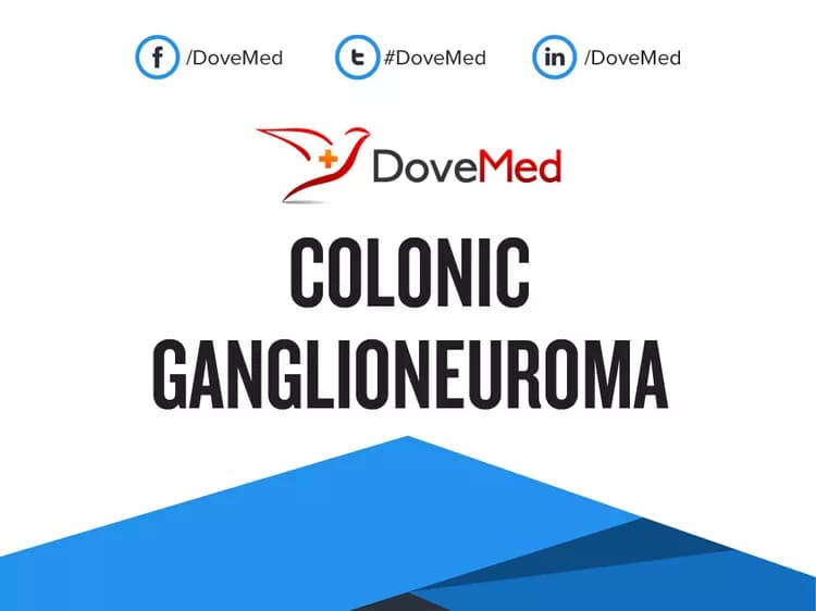 Colonic Ganglioneuroma