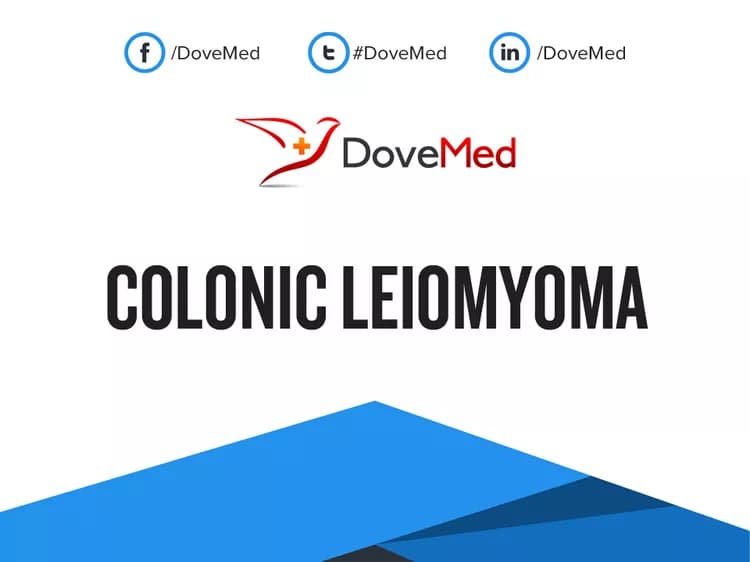 Colonic Leiomyoma