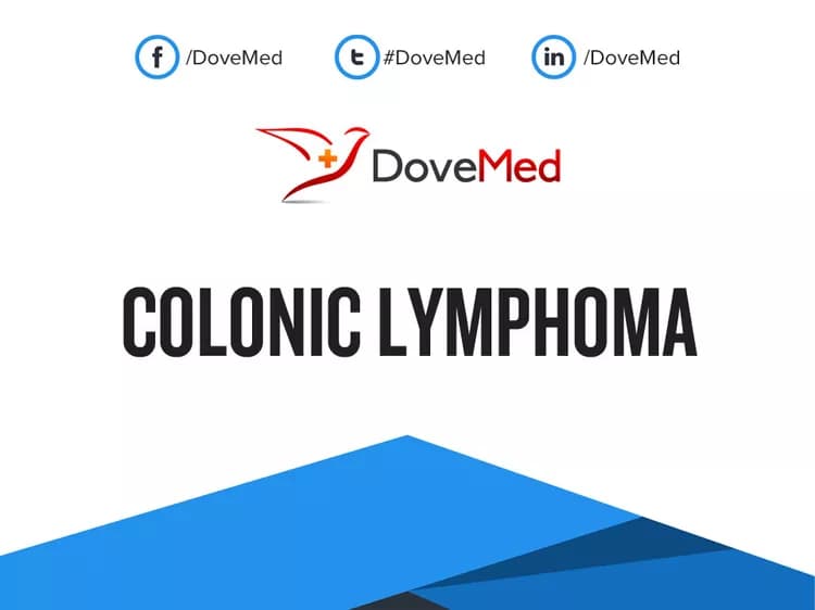 Colonic Lymphoma