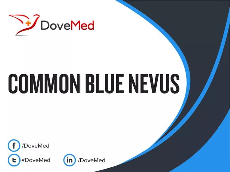 Common Blue Nevus