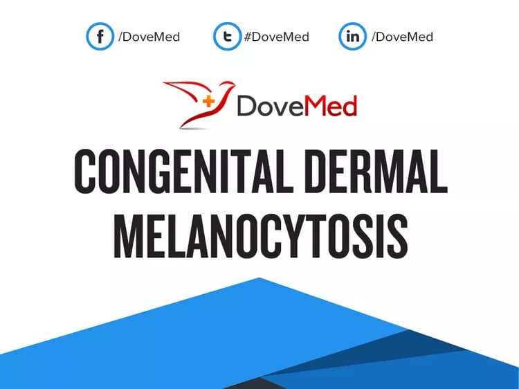 Congenital Dermal Melanocytosis