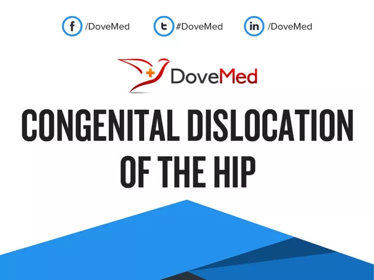 Congenital Dislocation of the Hip (CDH)