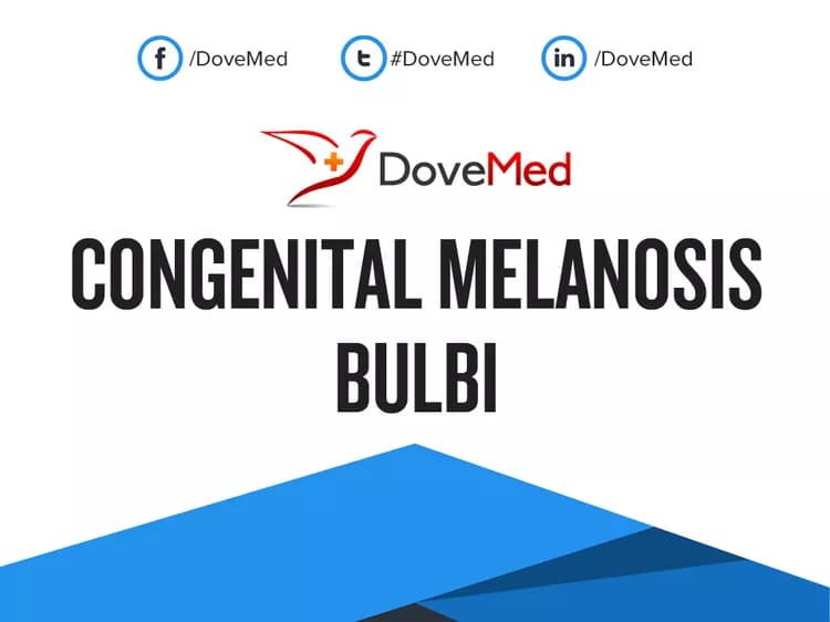 Congenital Melanosis Bulbi