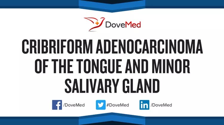 Cribriform Adenocarcinoma of the Tongue and Minor Salivary Gland