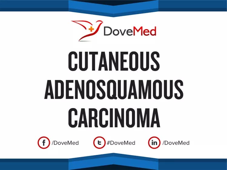 Cutaneous Adenosquamous Carcinoma