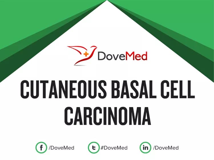 Cutaneous Basal Cell Carcinoma