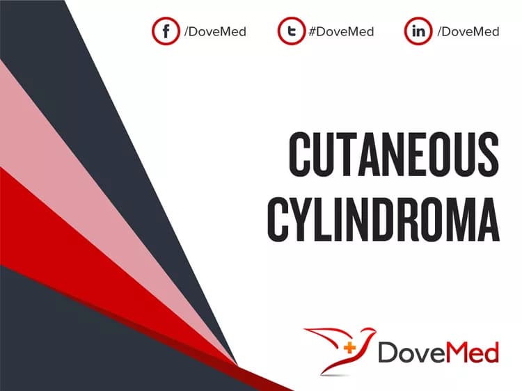 Cutaneous Cylindroma