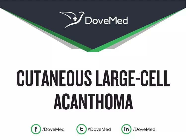 Cutaneous Large-Cell Acanthoma