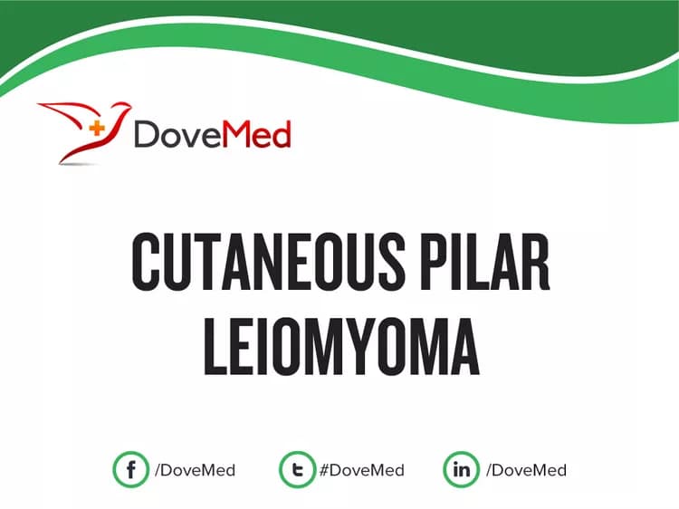 Cutaneous Pilar Leiomyoma