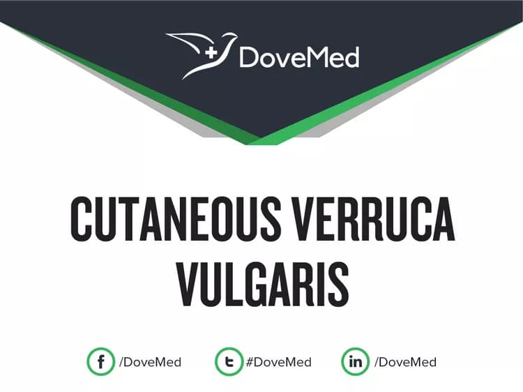 Cutaneous Verruca Vulgaris